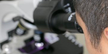 Puidukeemia. Foto: Pixabay